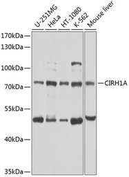 Anti-CIRH1A antibody used in Western Blot (WB). GTX66533