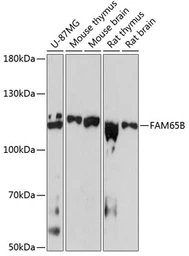 Anti-FAM65B antibody used in Western Blot (WB). GTX66562
