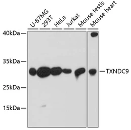 Anti-TXNDC9 antibody used in Western Blot (WB). GTX66578