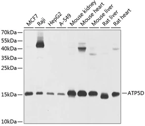 Anti-ATP5D antibody used in Western Blot (WB). GTX66588