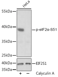 Anti-eIF2 alpha (phospho Ser51) antibody used in Western Blot (WB). GTX66600