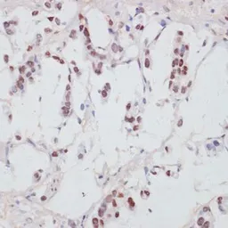 Anti-SRF (phospho Ser103) antibody used in IHC (Paraffin sections) (IHC-P). GTX66603