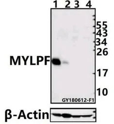 Anti-fast skeletal Myosin antibody used in Western Blot (WB). GTX66608
