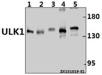 Anti-ULK1 antibody used in Western Blot (WB). GTX66612