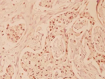 Anti-Fas Ligand antibody used in IHC (Paraffin sections) (IHC-P). GTX66619