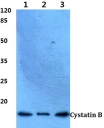 Anti-Cystatin B antibody used in Western Blot (WB). GTX66627