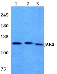 Anti-JAK3 antibody used in Western Blot (WB). GTX66640