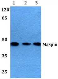 Anti-MASPIN antibody used in Western Blot (WB). GTX66666