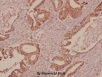 Anti-Galectin 7 antibody used in IHC (Paraffin sections) (IHC-P). GTX66682