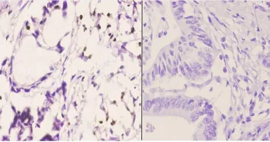 Anti-PU.1 antibody used in IHC (Paraffin sections) (IHC-P). GTX66691
