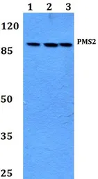 Anti-PMS2 antibody used in Western Blot (WB). GTX66694