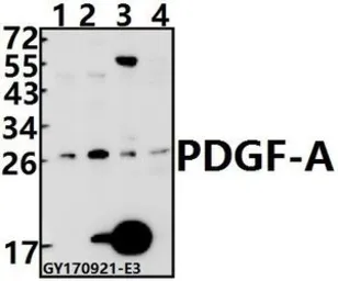 Anti-PDGFA antibody used in Western Blot (WB). GTX66716