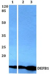 Anti-Defensin beta 1 antibody used in Western Blot (WB). GTX66761