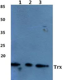 Anti-Thioredoxin antibody used in Western Blot (WB). GTX66767