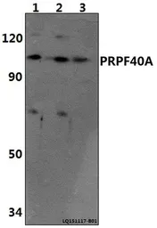 Anti-FNBP3 antibody used in Western Blot (WB). GTX66802