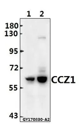 Anti-CCZ1 + CCZ1B antibody used in Western Blot (WB). GTX66826