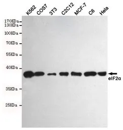 Anti-eIF2 alpha antibody [2E4] used in Western Blot (WB). GTX66838