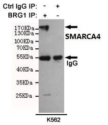 Anti-BRG1 antibody [6D7] used in Immunoprecipitation (IP). GTX66842