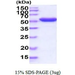 G6PD protein (active). GTX66884-pro
