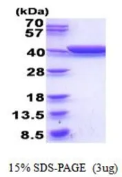 GldA protein, His tag (active). GTX66892-pro