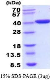 Idha protein, His tag (active). GTX66894-pro