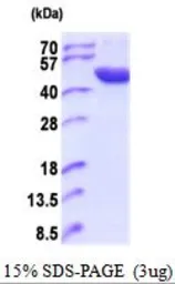 Human ACP6 protein, His tag (active). GTX66901-pro