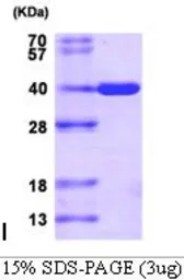 Human AKR1C3 protein, His tag (active). GTX66914-pro
