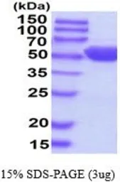 Human GPT protein, His tag (active). GTX67024-pro