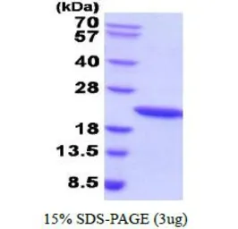 Human Growth Hormone protein (active). GTX67029-pro