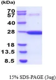 Mouse GSTP1 protein, His tag (active). GTX67041-pro