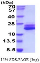 Human IL6 protein, His tag (active). GTX67071-pro