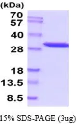 Human PGAM1 protein, His tag (active). GTX67110-pro