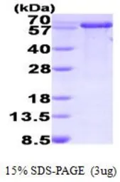 Human PPIL2 protein, His tag (active). GTX67132-pro