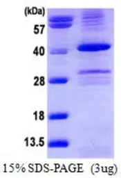Human PPP1A protein, His tag (active). GTX67136-pro