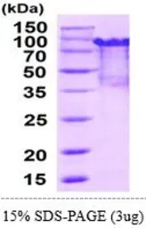 Mouse PRMT1 protein, His and MBP tag (active). GTX67138-pro
