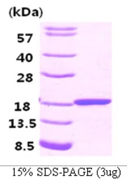 Human FABP3 protein, His tag. GTX67385-pro