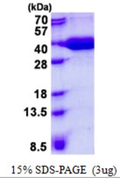 Human MPST protein, His tag. GTX67561-pro