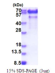 Human Paralemmin protein, His tag. GTX67611-pro
