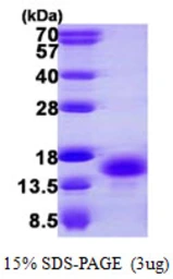 Human PKIB protein, His tag. GTX67672-pro