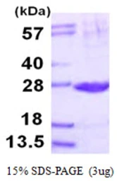 Human PSMB2 protein, His tag. GTX67696-pro