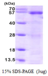 Human PTEN protein, His tag. GTX67706-pro