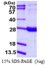 Human RBP1 protein, His tag. GTX67743-pro