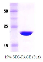 Human Recoverin protein. GTX67745-pro