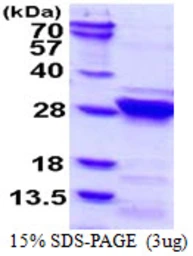 Human RGS4 protein, His tag. GTX67748-pro