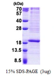 Human RPL22 protein, His tag. GTX67762-pro