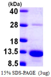 Human S100A5 protein, His tag. GTX67790-pro
