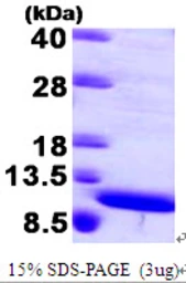 Human S100A8 protein. GTX67793-pro