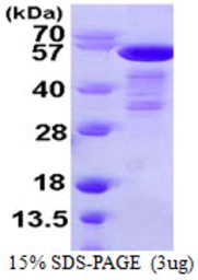 Human SHC1 protein, His tag. GTX67818-pro