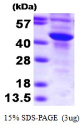 Human SULT2B1 protein. GTX67864-pro