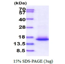 Human Elongin B protein. GTX67876-pro